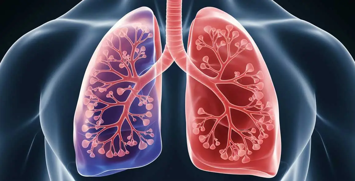 COPD Lunge Illustration.